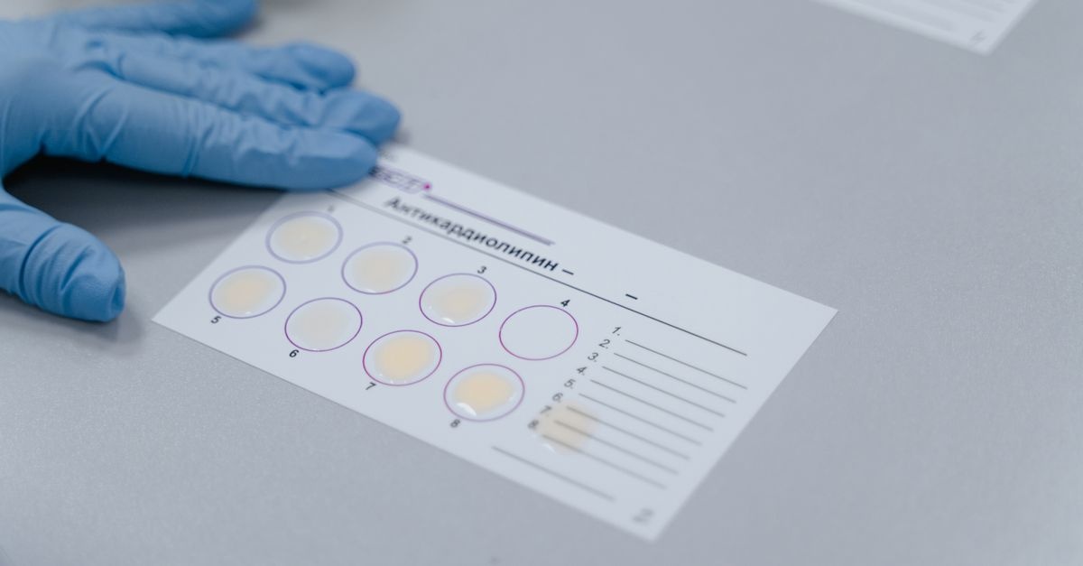 Zöliakie-Verdacht? Warum du dich vor dem Glutenverzicht testen lassen solltest
