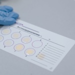Zöliakie-Verdacht? Warum du dich vor dem Glutenverzicht testen lassen solltest